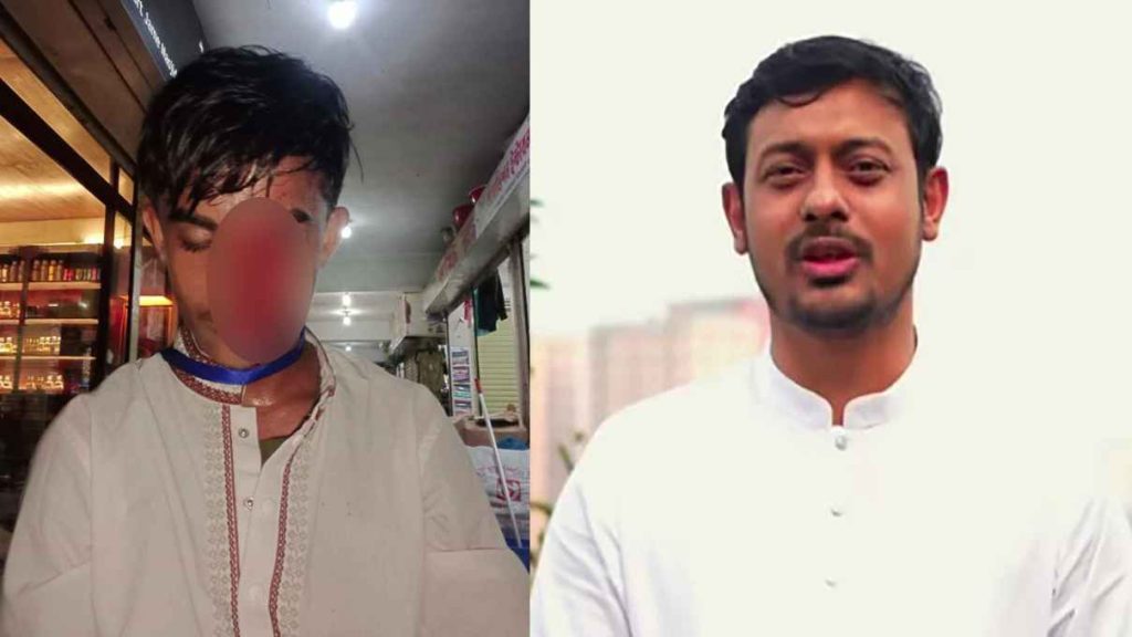 মাননীয় প্রধানমন্ত্রী, প্লিজ ছেলেটার চোখ ফিরিয়ে দিন: আর্জি পাটওয়ারীর
